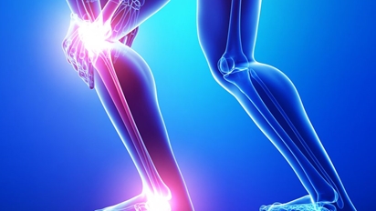 حفظ سلامت غضروف و منیسک زانو کلید پیشگیری از آرتروز است